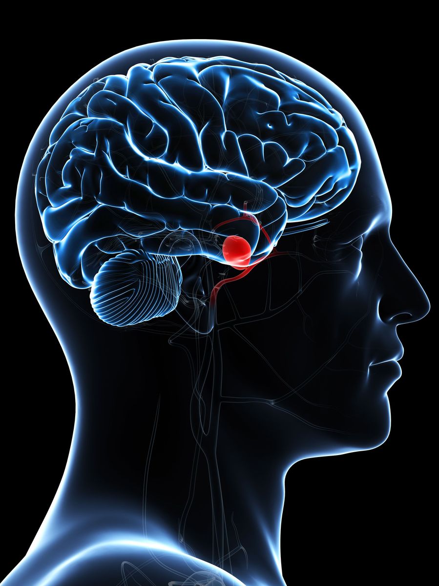 Аневризма мозга отзывы. Аневризма головного мозга. Красивый мозг. Мозг с нервными окончаниями.